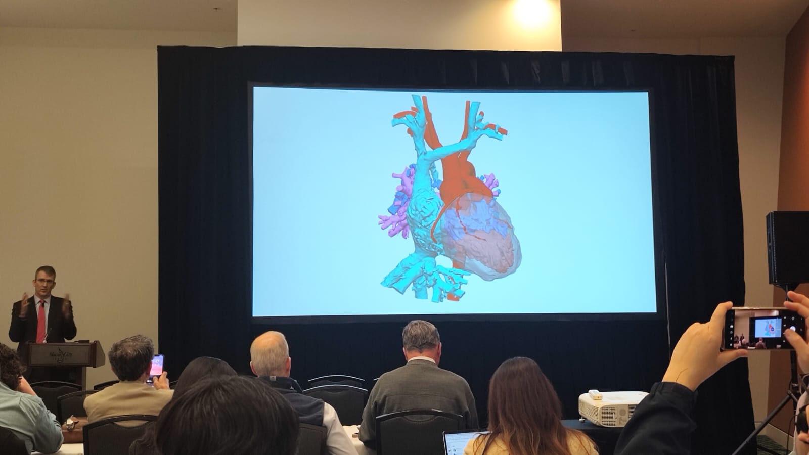 Cara 3DExperience Works Bantu Dunia Medis Ciptakan Organ Hati Digital