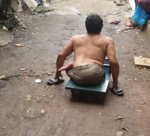 Bocah Ini Mengurus Adik dan Ayah yang Polio