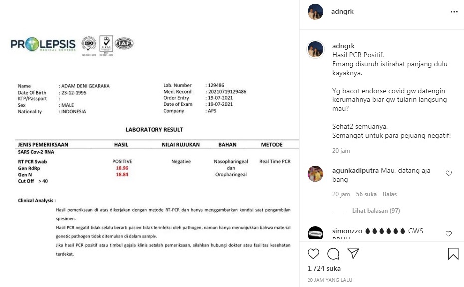 Adam Deni Positif Covid-19, Sindir Jerinx Sebut Ingin Bertamu