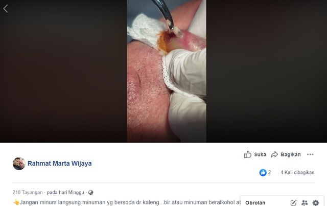 [Cek Fakta] Cacing Parasit yang Dikeluarkan dari Dalam Bibir Pria Ini Berasal dari Kaleng Minuman? Ini Faktanya