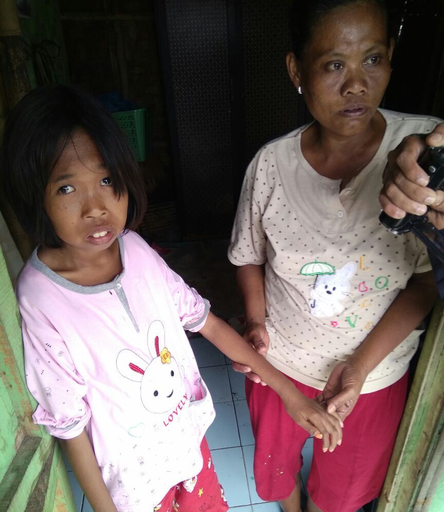 Bocah 13 Tahun Idap Gizi Buruk di Tangerang