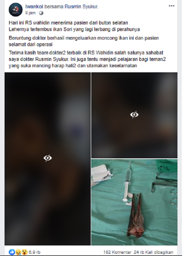 [Cek Fakta] Seekor Ikan Terbang dan Menancap di Leher Bocah? Ini Faktanya