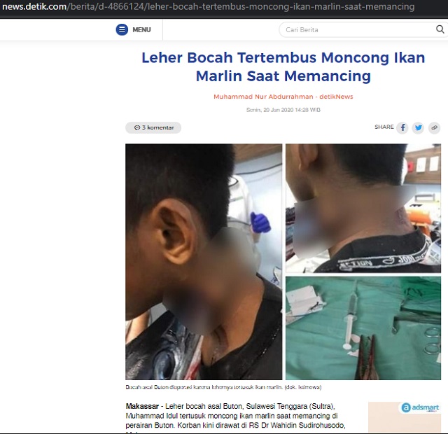 [Cek Fakta] Seekor Ikan Terbang dan Menancap di Leher Bocah? Ini Faktanya