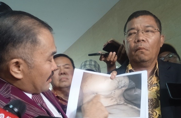Mengenal Istilah Ekshumasi dalam Proses Autopsi Ulang Brigadir J