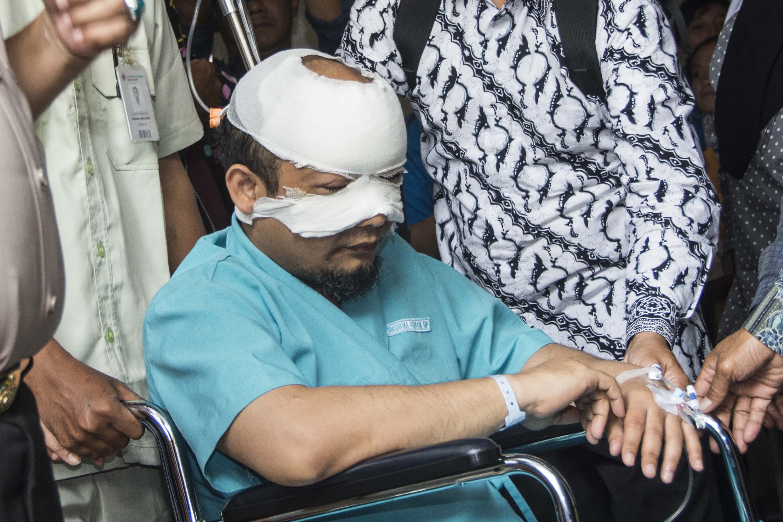 Tercium Ketidakprofesionalan Polri pada Kasus Novel