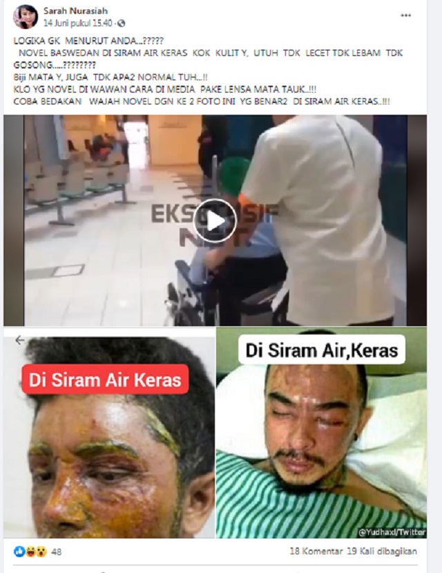 [Cek Fakta] Video Ini Dijadikan Dasar Meragukan Mata Novel Baswedan Rusak? Simak Faktanya