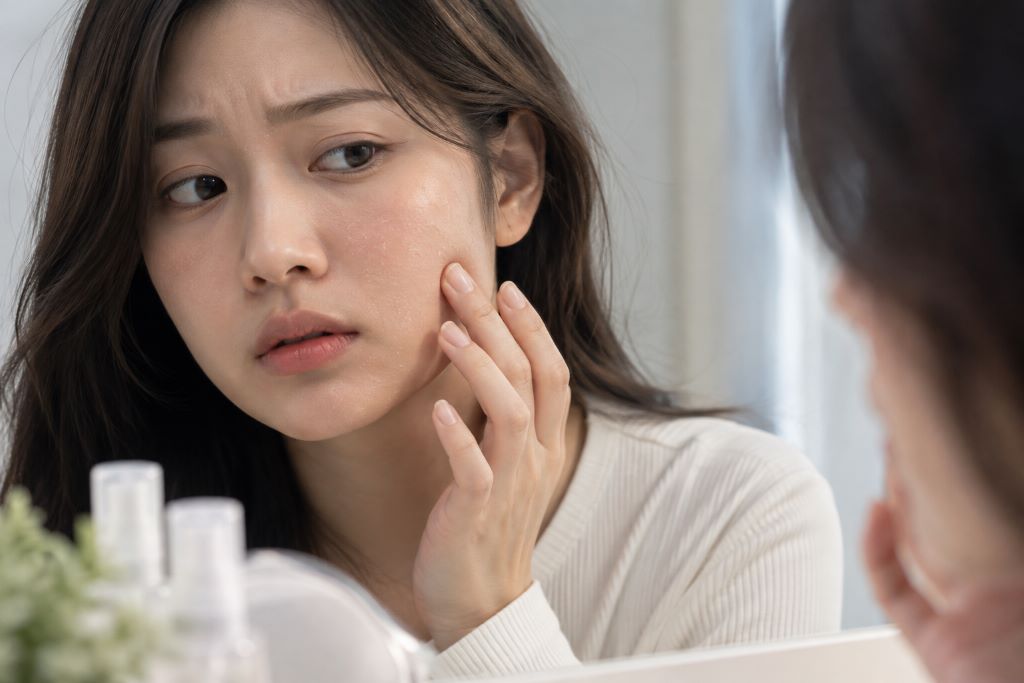 skinbarrier