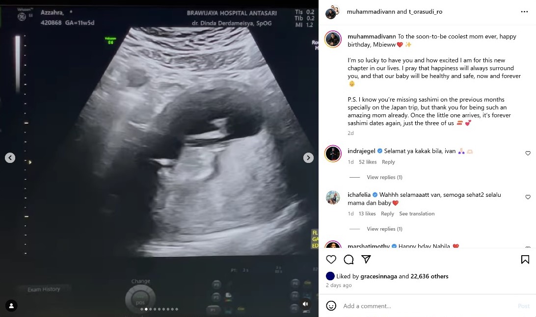 Tora Sudiro Segera Jadi Kakek, Putri Sulungnya Hamil Anak Pertama