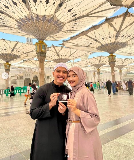 Erina Gudono Hamil Anak Pertama, Kaesang Pangarep: Hadiah dari Allah SWT