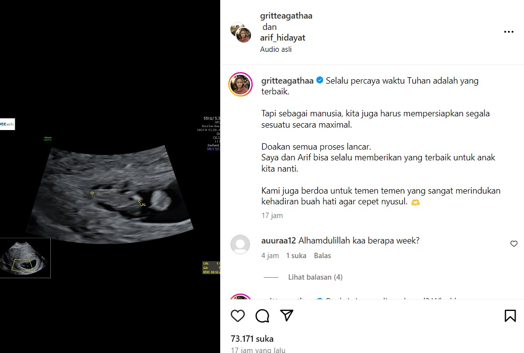 Selamat! Gritte Agatha Umumkan Hamil Anak Pertama - Medcom.Id