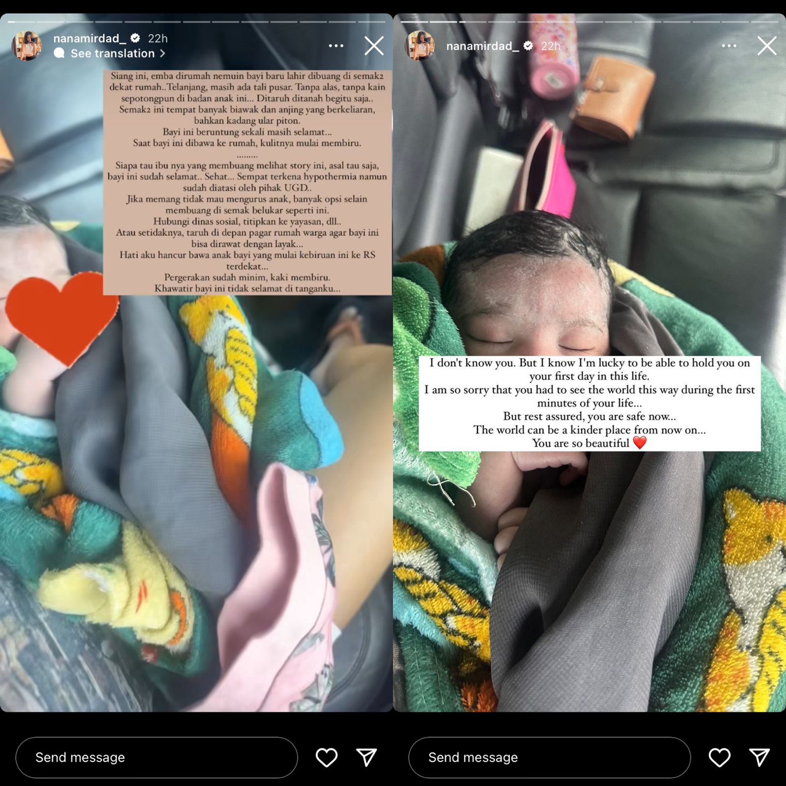 Nana Mirdad Temukan Bayi di Semak Dekat Rumah, Kondisinya Memprihatinkan