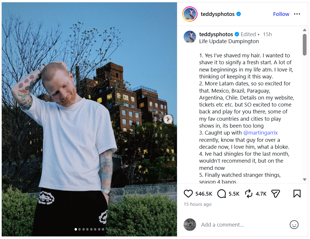 Ed Sheeran Sakit Herpes