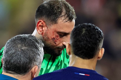 Dapat 10 Jahitan di Wajah, Ini Fakta-fakta Cedera Horor Donnarumma